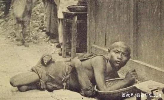 吃瓜活人解剖,一场惊心动魄的医学探秘之旅